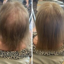 Hair Integration Solution 1