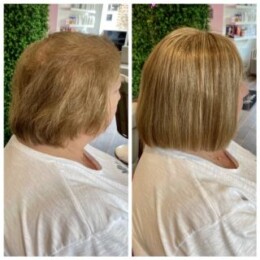 Hair Integration Solution 2